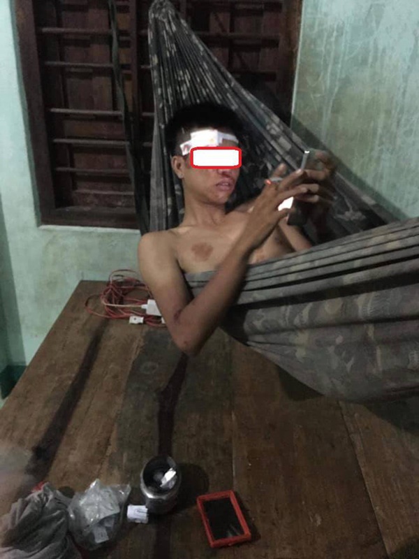 Đi xe máy thả hai tay múa quạt, cặp thanh niên nhận cái kết đầy đau thương-5