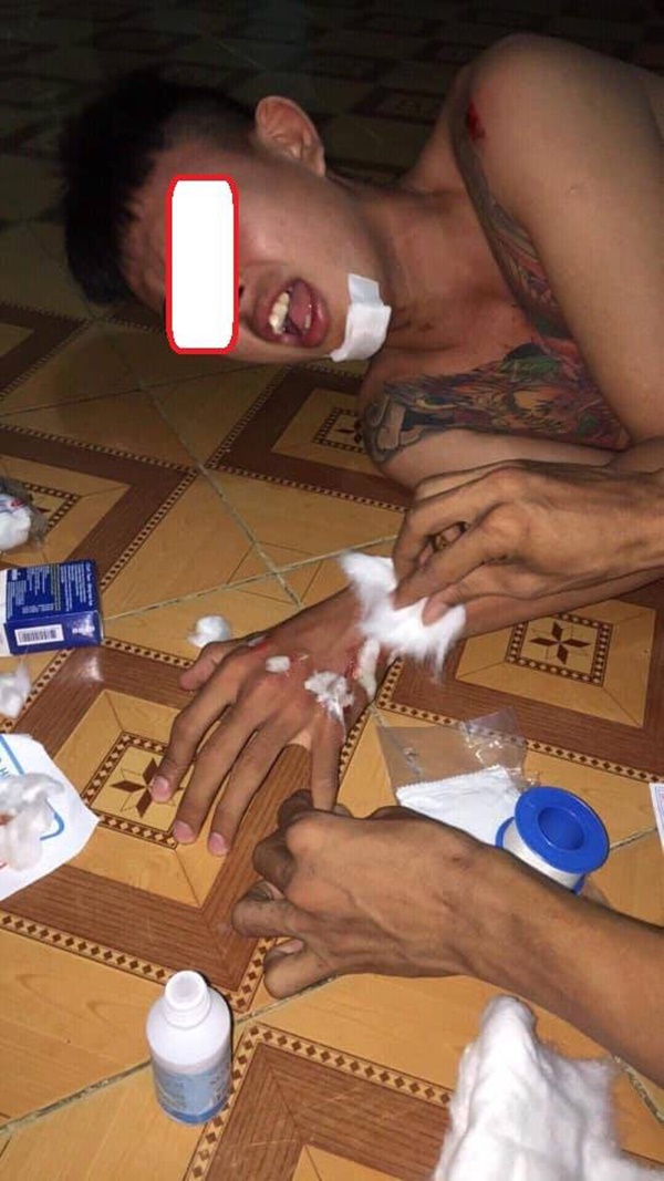 Đi xe máy thả hai tay múa quạt, cặp thanh niên nhận cái kết đầy đau thương-6