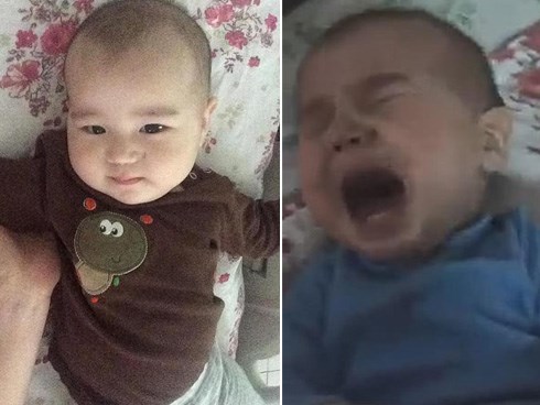 Đưa con trai 10 tháng tuổi đến bệnh viện điều trị bệnh hô hấp, bố mẹ đau đớn thấy cơ thể con bị hủy hoại vì sai lầm khủng khiếp của y tá