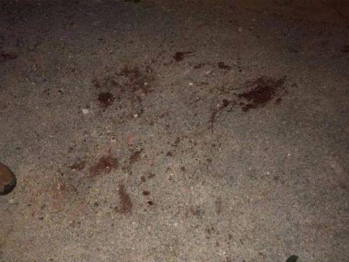 Công an vào cuộc làm rõ vụ việc đàn chó 10 con cắn bé trai 7 tuổi tử vong