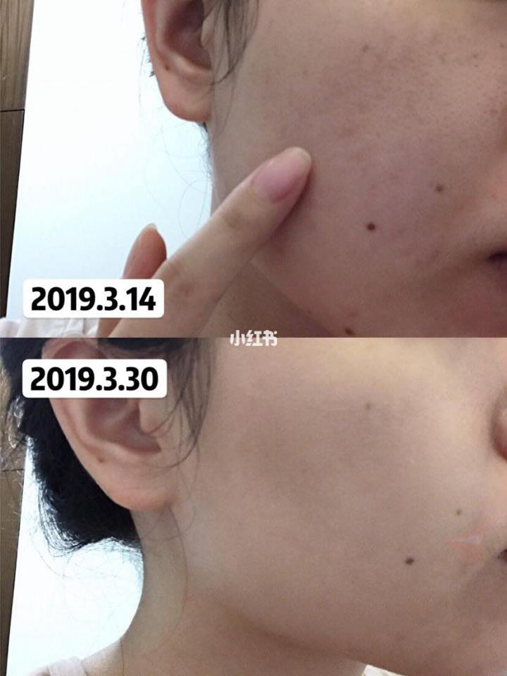 Để da mướt mát không lỗ chân lông, hội con gái Trung Quốc đang truyền tai bí kíp đắp khăn nóng vô cùng đơn giản-2