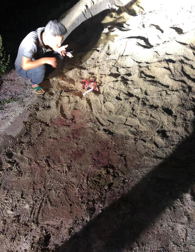 Người phụ nữ giải cứu bé trai bị gần 10 con chó lao vào cắn tử vong: Cháu chỉ nói được tên bố mẹ rồi ngất lịm đi-1