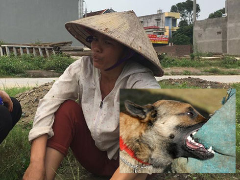 Vụ đàn chó cắn bé trai 7 tuổi tử vong: Lời kể hãi hùng của 1 nạn nhân từng may mắn thoát chết-6