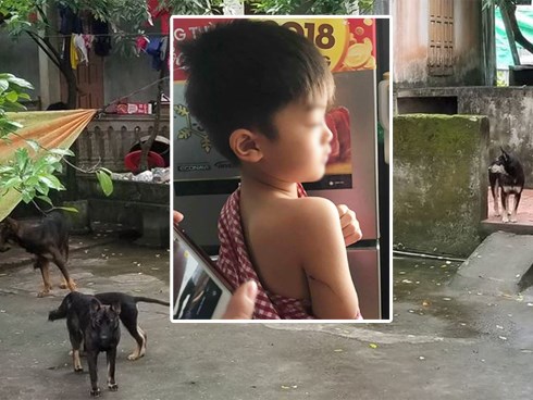 Vụ đàn chó cắn bé trai 7 tuổi tử vong: Lời kể hãi hùng của 1 nạn nhân từng may mắn thoát chết