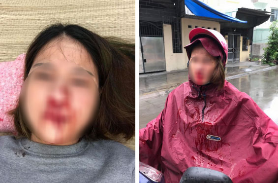 Vụ phản bội hot nhất MXH: Vợ đi mót rau nuôi chồng thuở hàn vi, có nhà lầu xe hơi thì chồng cặp bồ, đánh vợ đổ máu-2