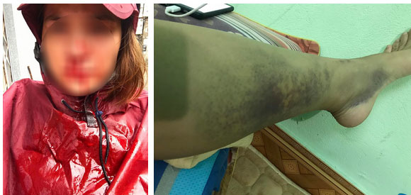 Vụ phản bội hot nhất MXH: Vợ đi mót rau nuôi chồng thuở hàn vi, có nhà lầu xe hơi thì chồng cặp bồ, đánh vợ đổ máu-3