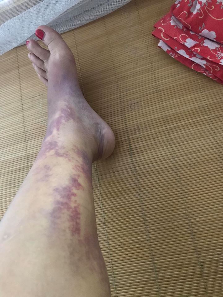 Vụ phản bội hot nhất MXH: Vợ đi mót rau nuôi chồng thuở hàn vi, có nhà lầu xe hơi thì chồng cặp bồ, đánh vợ đổ máu-4