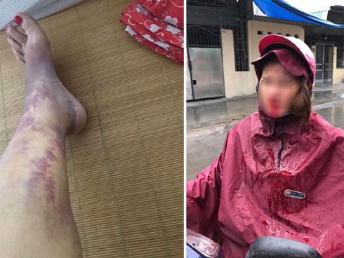 Vụ phản bội hot nhất MXH: Vợ đi mót rau nuôi chồng thuở hàn vi, có nhà lầu xe hơi thì chồng cặp bồ, đánh vợ đổ máu