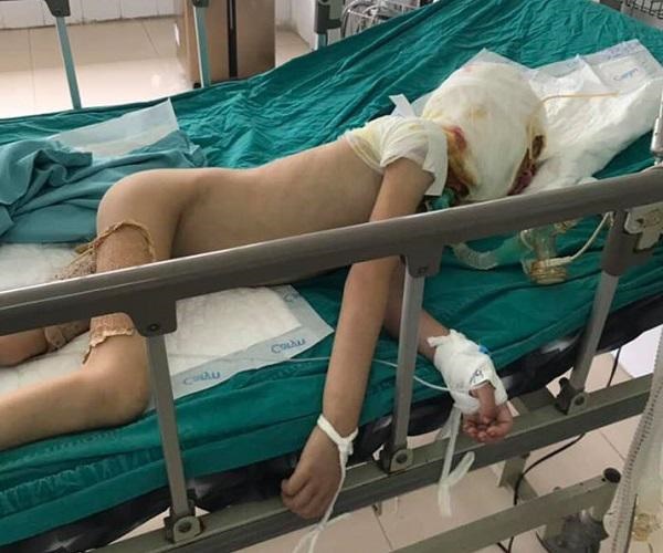 Ra ngoài vài giây, mẹ Cao Bằng chết đứng khi nhìn cảnh tượng xảy đến với con trai-1