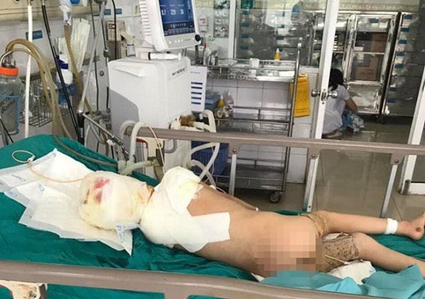 Ra ngoài vài giây, mẹ Cao Bằng chết đứng khi nhìn cảnh tượng xảy đến với con trai-3