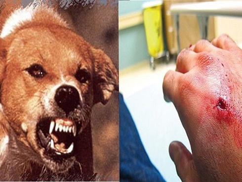 Kém hiểu biết, ông bố trẻ mắc căn bệnh khiến bác sĩ bó tay-2