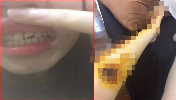 Người phụ nữ tố bị kẻ biến thái cố ý va chạm giao thông, sờ vào vùng kín rồi bỏ trốn khi bị chống cự-1