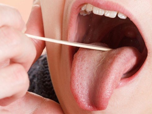 Nếu bạn hay bị cắn vào lưỡi khi ăn: Đừng bỏ qua 3 yếu tố này, có thể là bệnh nguy hiểm