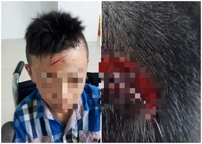 Vĩnh Long: Xác minh thông tin nam sinh lớp 7 bị bạn đánh chảy máu đầu, ngất xỉu 2 lần nhưng nhà trường không đưa đi cấp cứu-1