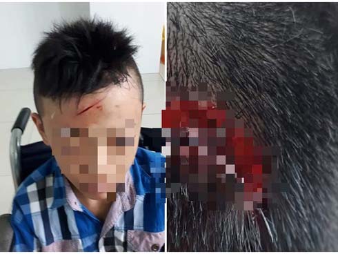 Clip sốc: Một nữ sinh bị 12 bạn cùng trường đánh, đạp túi bụi, phải nhập viện vì tụ máu não-3