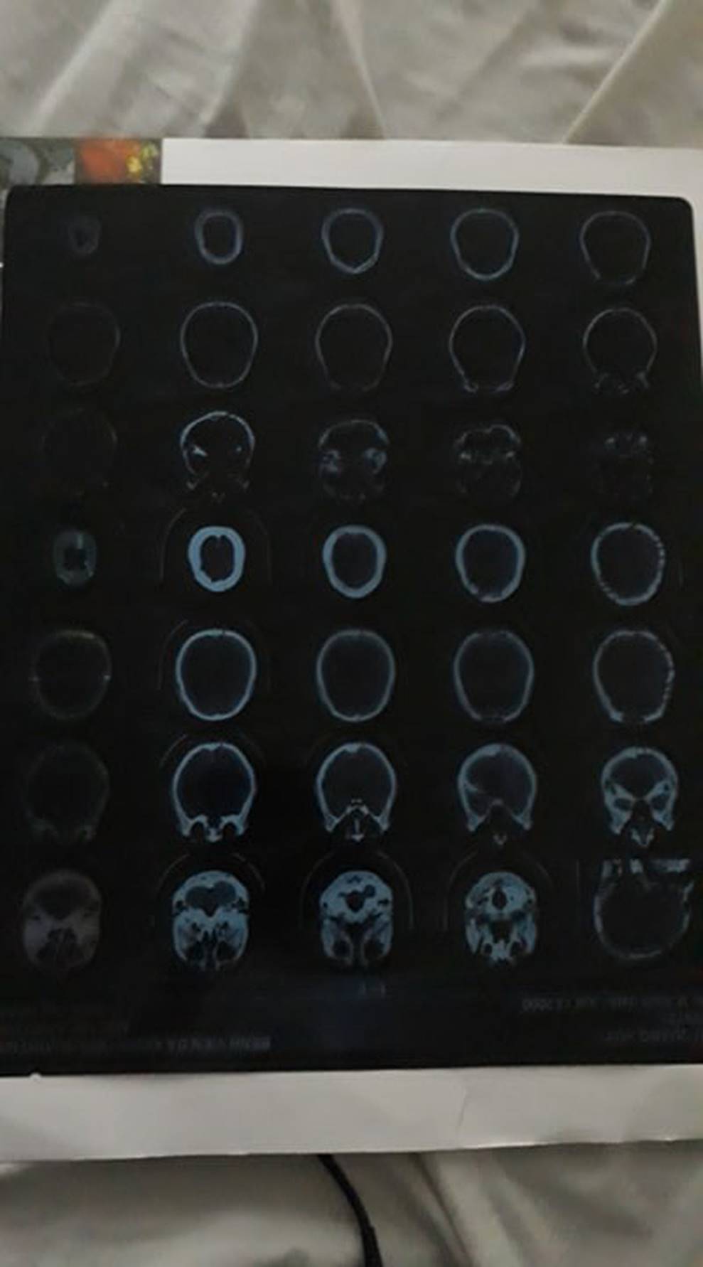 Vụ nữ sinh bị đánh hội đồng ở Quảng Ninh: Từng có mâu thuẫn nhưng đã giải quyết ổn thỏa từ lâu-4