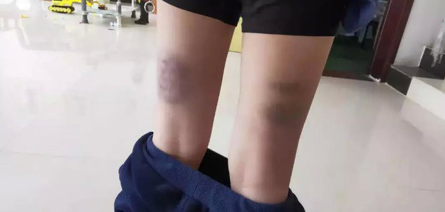 Giáo viên tiếng Anh ra hình phạt học tập: Thấp hơn 1 điểm đánh 10 roi, có em bị đánh đến 840 roi, phụ huynh phẫn nộ dữ dội-1