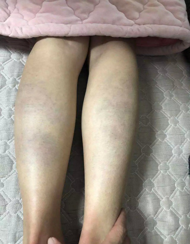 Giáo viên tiếng Anh ra hình phạt học tập: Thấp hơn 1 điểm đánh 10 roi, có em bị đánh đến 840 roi, phụ huynh phẫn nộ dữ dội-2