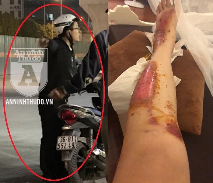 Xuất hiện kẻ bệnh hoạn chuyên xâm hại các cô gái trên đường phố HN-3