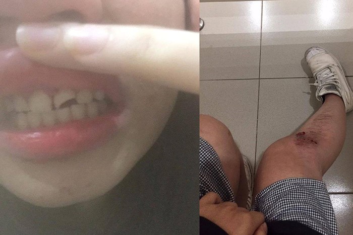 Xuất hiện kẻ bệnh hoạn chuyên xâm hại các cô gái trên đường phố HN-4