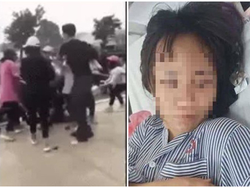 Phẫn nộ hình ảnh học sinh lớp 8 bị bố đánh bầm dập” ngất xỉu tại lớp, nhà trường phải đưa đi cấp cứu-4