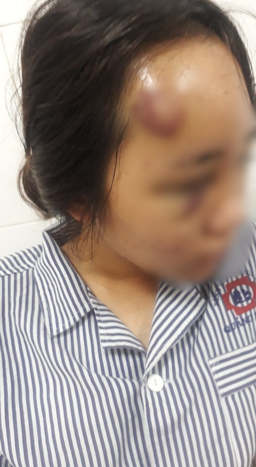 Mẹ của nữ sinh bị hành hung ở Hạ Long: Con tôi từng đánh nhau với nhóm kia nhưng đã xin lỗi rồi, không ngờ bị đánh lại-1