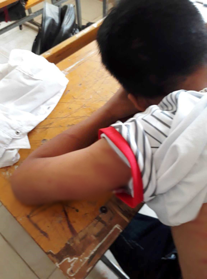 Phẫn nộ hình ảnh học sinh lớp 8 bị bố đánh bầm dập” ngất xỉu tại lớp, nhà trường phải đưa đi cấp cứu-3