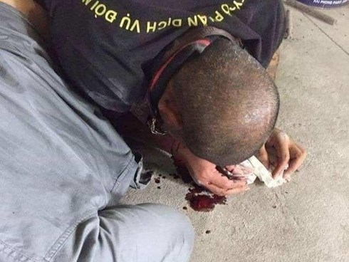 Vụ 3 người đi đòi nợ thuê bị đánh bầm dập, phải quỳ lạy: 'Con nợ' từng là đặc công nước