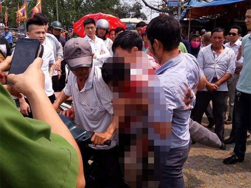 Nữ tài xế Mercedes mất lái đâm hàng loạt xe máy khiến 3 nạn nhân bị thương, nhiều người hoảng loạn-13