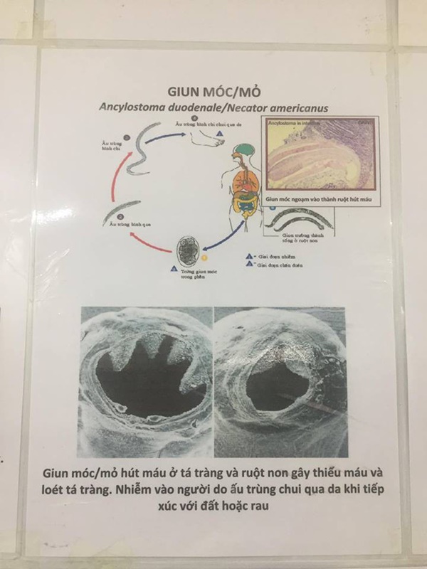 Con sốt triền miên không rõ nguyên nhân, mẹ đưa đi xét nghiệm mới tá hỏa biết con nhiễm loại kí sinh trùng kinh hãi-7