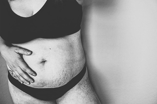 Bị dè bỉu cơ thể sau sinh là dơ dáy, ghê tởm, bà mẹ 1 con chỉ dùng đúng hành động này để đáp trả khiến bao người phải nể phục-3