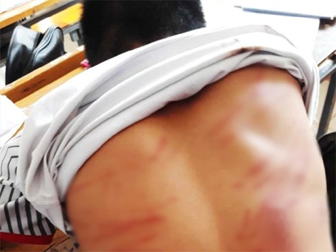 Lời khai của ông bố đánh nam sinh lớp 8 bầm dập lưng, ngất xỉu tại lớp