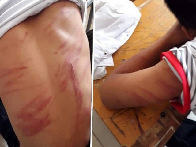 Bố của nam sinh lớp 8 bị ngất xỉu ở trên lớp: Tôi rất ân hận vì đánh con quá nặng tay-3