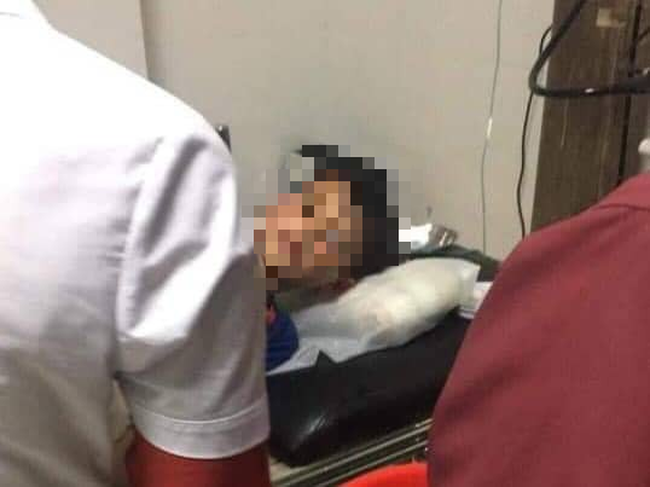 Sơn La: Thêm một bé trai 11 tuổi bị chó dại cắn, sau 3 tháng điều trị đã tử vong-1