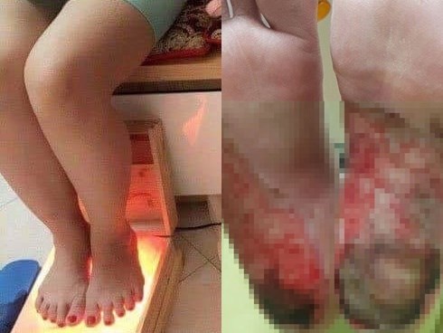 Dùng muối đá Himalaya bị hoại tử chân và những nguy hiểm khủng khiếp