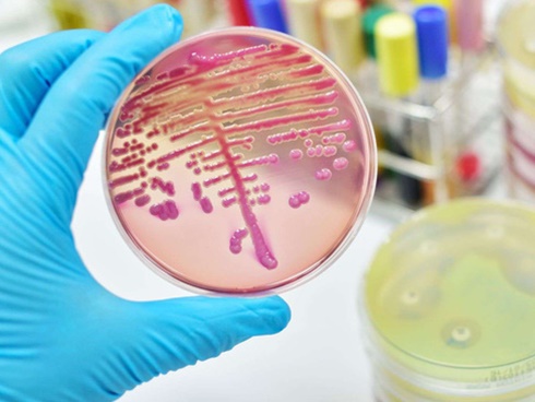 Cảnh báo: Đã có trường hợp tử vong do nhiễm chủng nấm mới siêu mạnh đang hoành hành khắp toàn cầu-5