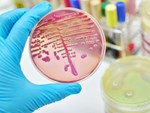 Cảnh báo: Đã có trường hợp tử vong do nhiễm chủng nấm mới siêu mạnh đang hoành hành khắp toàn cầu-5