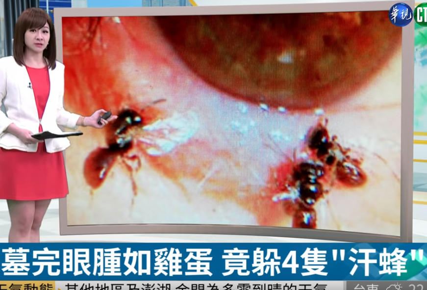 4 con ong sống ký sinh trong mí mắt cô gái, uống nước mắt vật chủ để sinh tồn-1