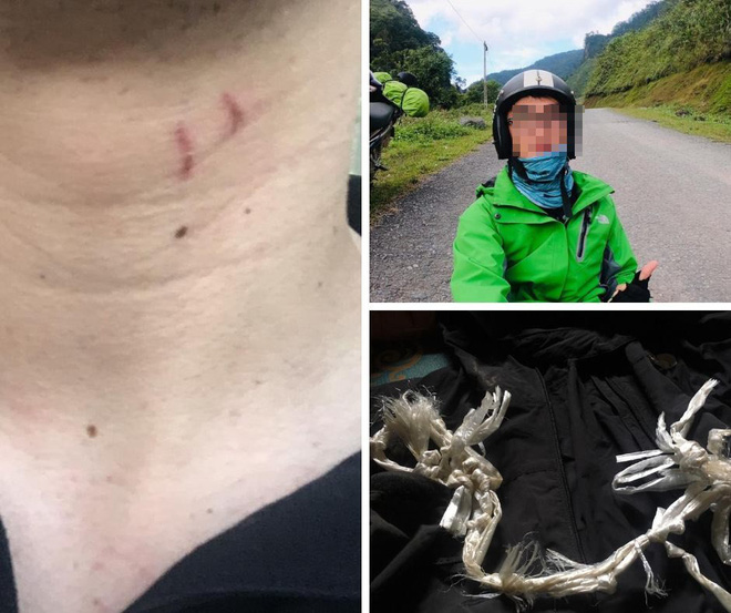 Thanh niên kể bị tra tấn dã man, thả cho kiến cắn khi phượt rừng Tam Đảo cùng nhóm bạn gái-2