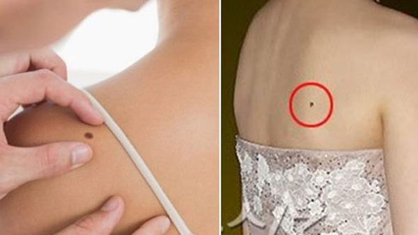 Chỉ tận nơi 6 nốt ruồi phú quý ẩn giấu trên TẤM LƯNG ngọc ngà của phụ nữ, chớ dại mà xóa bỏ-1