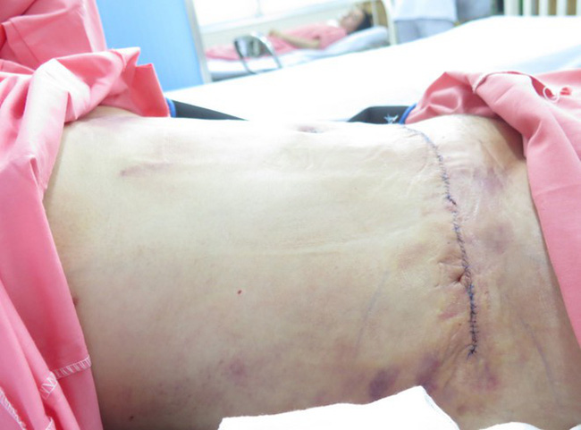 Xôn xao thông tin cô gái trẻ tử vong khi đi hút mỡ bụng-1