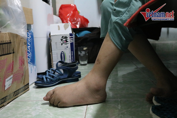 Thúy Anh muốn cắn lưỡi chết khi úng thủy não, liệt hai chân sau sinh, nợ hơn 200 triệu-2