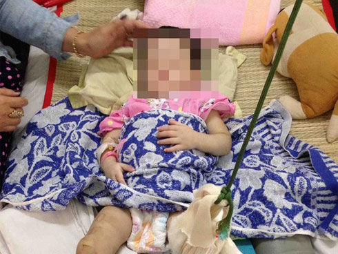 Bé gái bị mẹ nuôi đánh gãy chân: Nụ cười bé thơ và nỗi xót xa-2