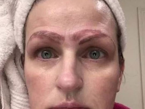 TP.HCM: Xăm chân mày tại một cơ sở thẩm mỹ một bệnh nhân nữ nhập viện tình trạng hôn mê, ngừng hô hấp-3