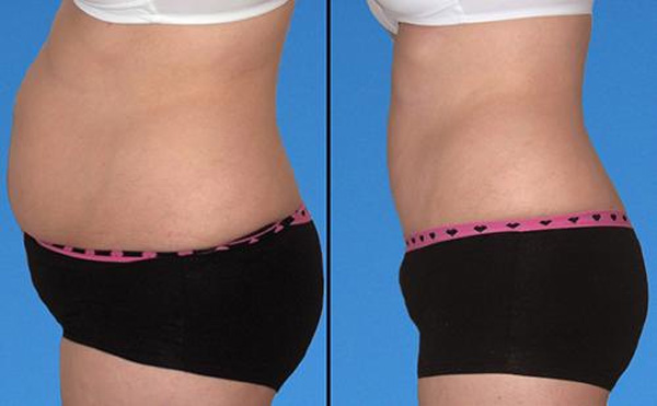 Mỗi tối trước khi đi ngủ uống 1 cốc nước này, mỡ bụng đến mấy cũng sẽ dần tiêu biến-10