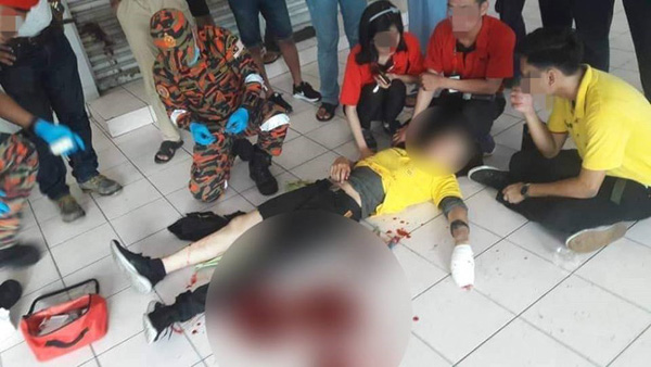 Chụp ảnh tự sướng trong nhà hàng, thanh niên bị đánh chí tử vì lý do không ai ngờ đến-2