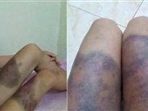 Thông tin sốc vụ thai phụ 18 tuổi bị giam, tra tấn khiến thai nhi tử vong-3