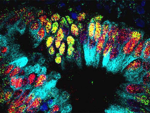 Đau ở hậu môn: Nếu kèm theo sốt thì phải đến gặp bác sĩ ngay lập tức-3