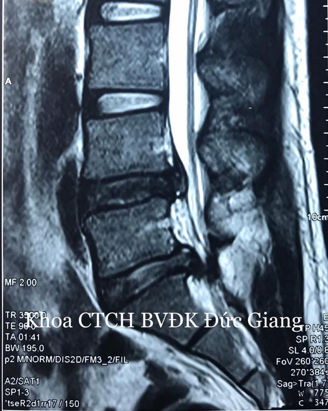 Đau lưng đột ngột không đại tiện được, thủ phạm là thói quen rất xấu của người Việt-2