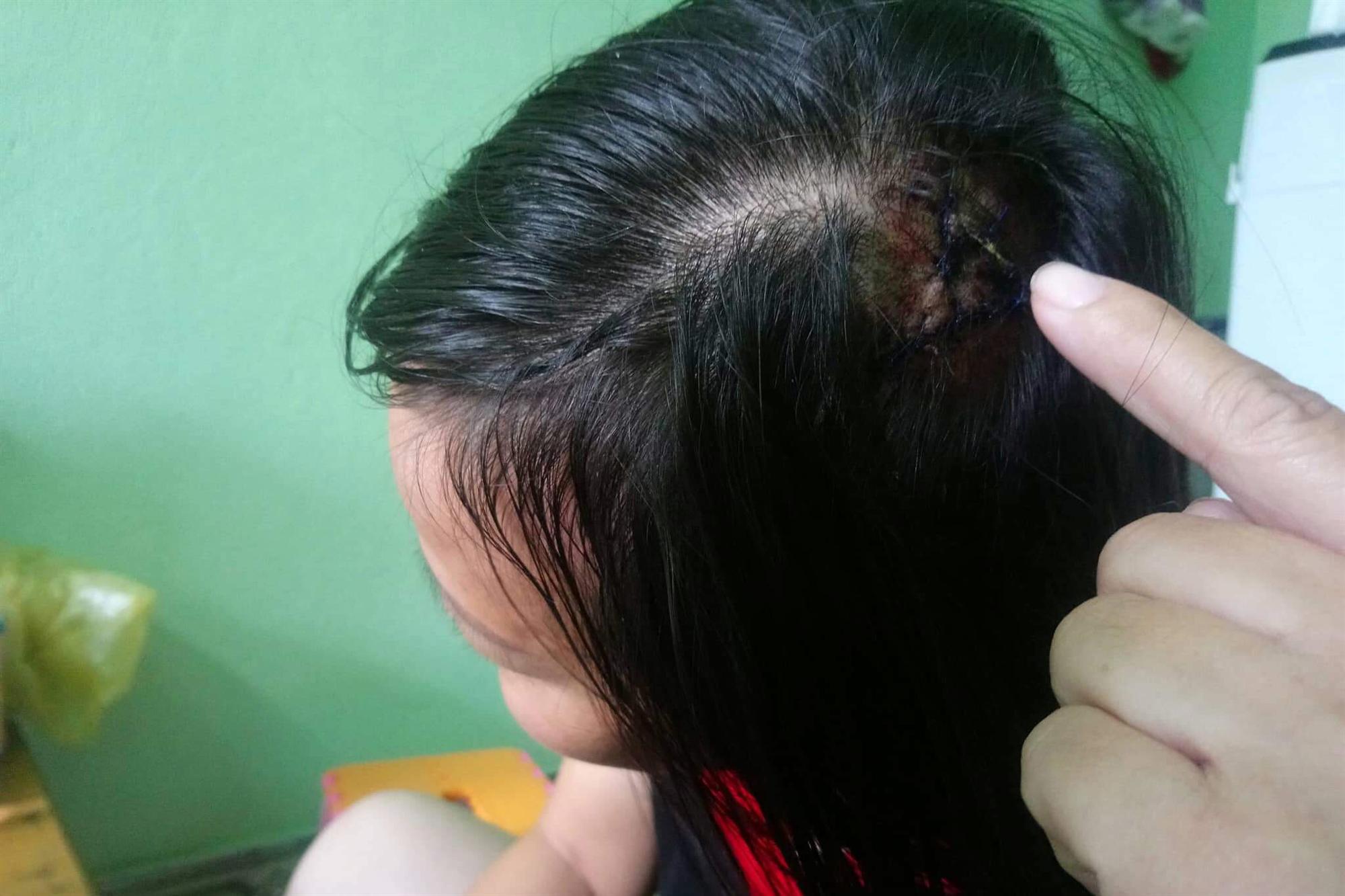 Nữ tài xế taxi tố bị bảo vệ bệnh viện dùng tuýp sắt đánh rách đầu-1